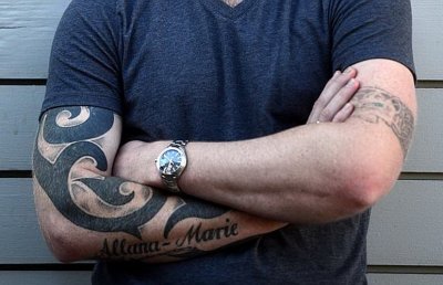 Удаление татуировок вызывает риск развития рака кожи