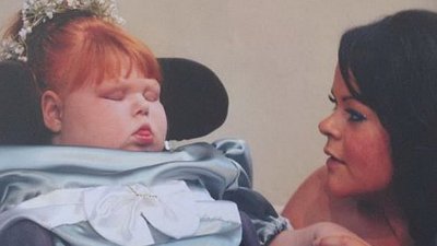 Женщине из Великобритании дали право на эвтаназию ее дочери Нэнси