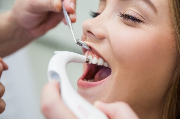 Необходимость ультразвуковой чистки в стоматологии